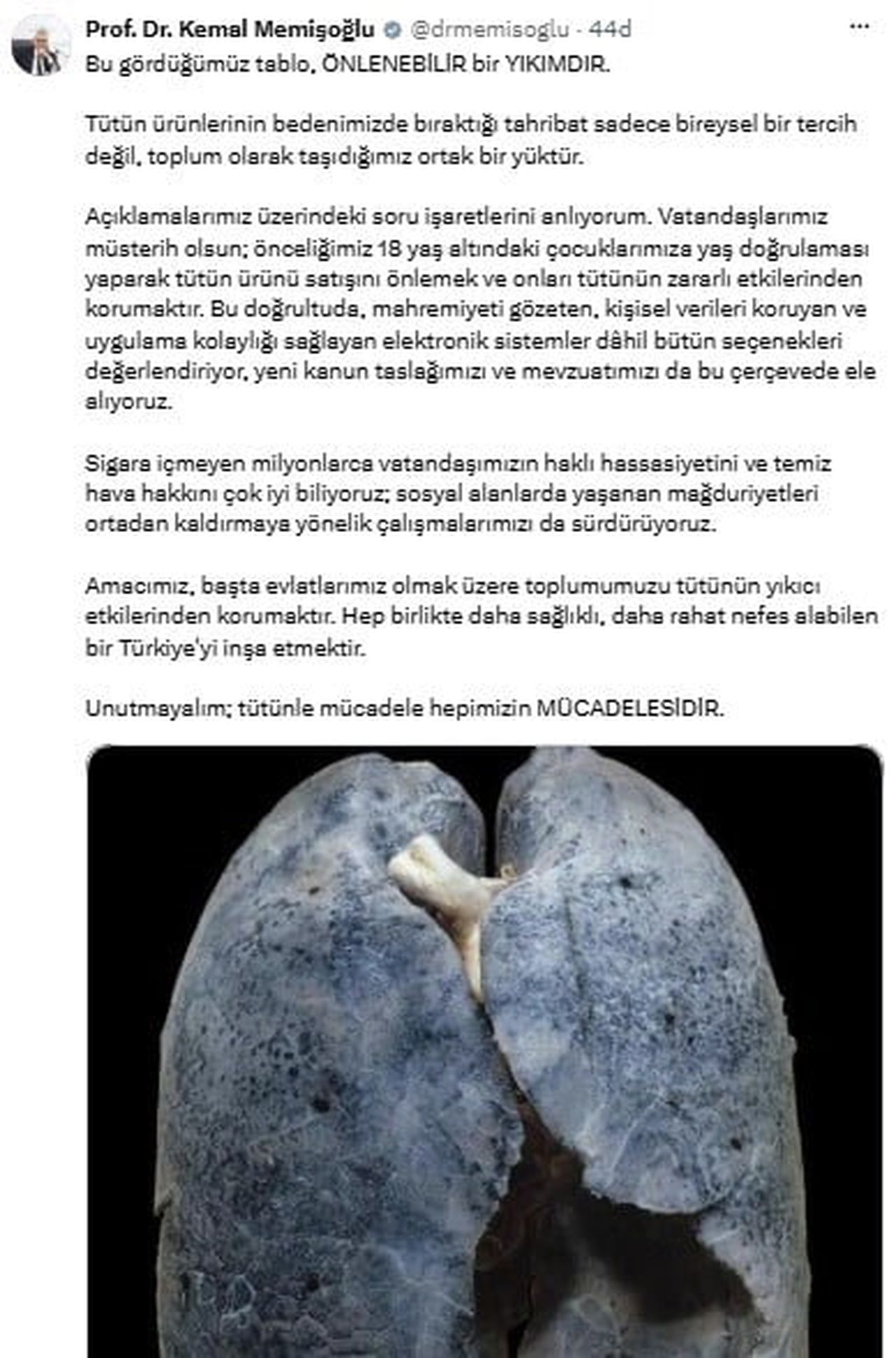 SAĞLIK BAKANI KEMAL MEMİŞOĞLU, SOSYAL MEDYA HESABI ÜZERİNDEN BİR İNSANA AİT SAĞLIKSIZ BİR AKCİĞER...