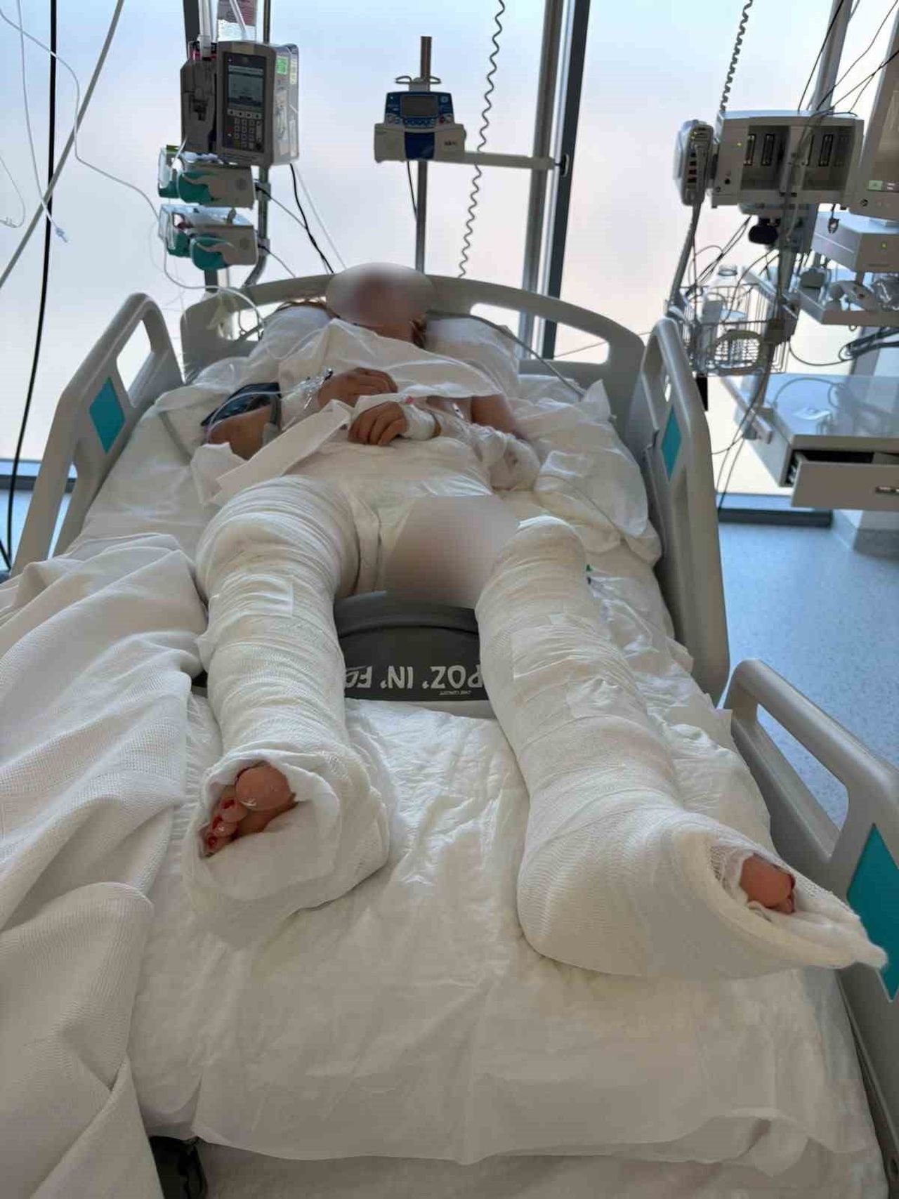 KOCAELİ’DE OTOMOBİLİN ÇARPTIKTAN SONRA ÜZERİNDEN GEÇTİĞİ 17 YAŞINDAKİ ASLI KARA, AĞIR YARALI...