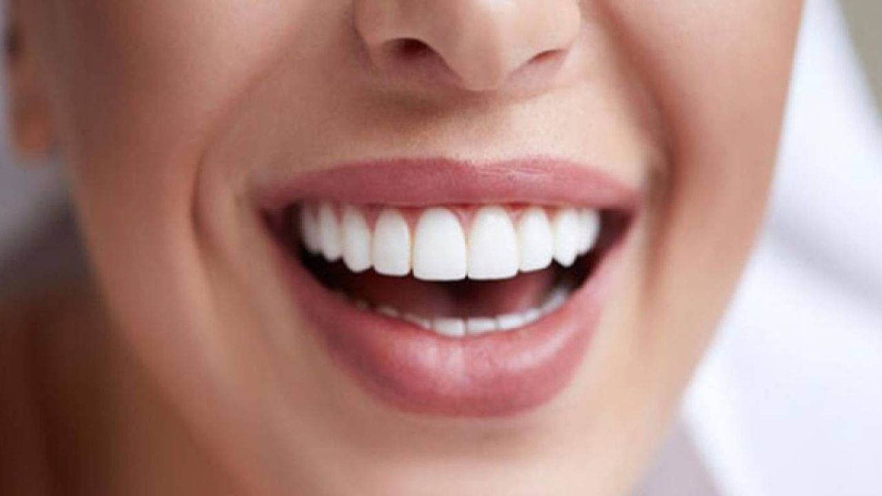 Dişlerdeki sarı ve kahverengi lekeleri çıkarmanın kolay yolu! Dişçide acı çekmenize gerek kalmayacak