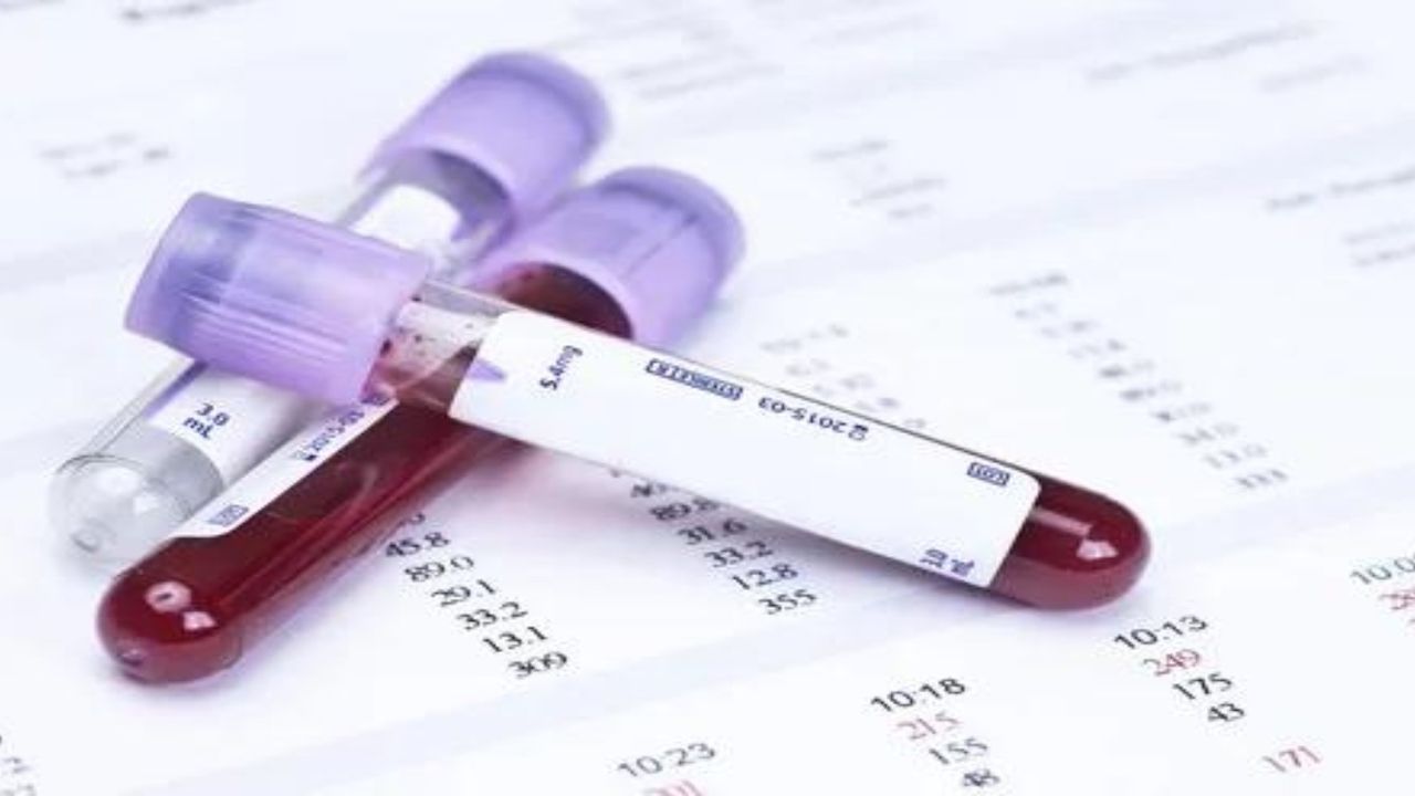 Tanısı zor, belirtileri değişken, tedavisi yok: Porfiriya! Kan, idrar ve dışkında bu varsa…