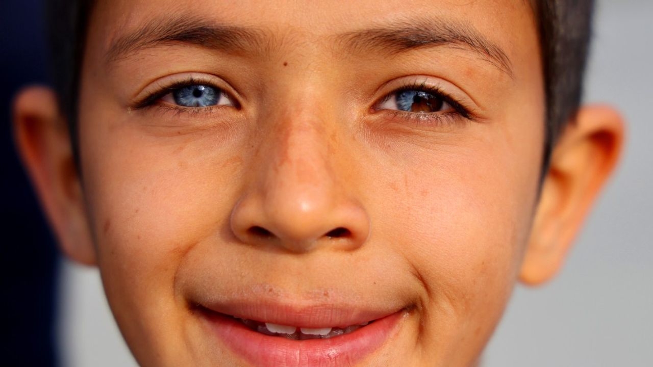 Adana’da doğan çocuk, gözleriyle büyülüyor: Bir gözü mavi, diğer gözü iki renkli