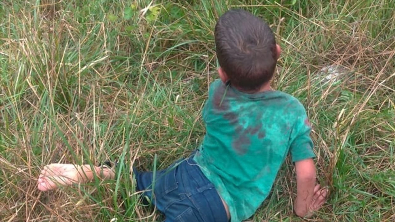 Yalova'da Sahipsiz Köpeklerden 5 Yaşındaki Çocuğa Saldırı