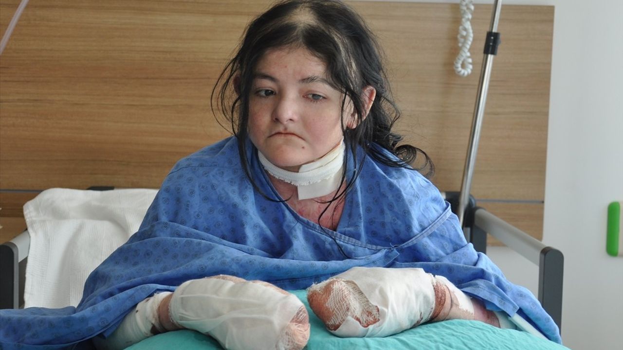 ABD'li Genç Kız, Eskişehir'de 'Kelebek Hastalığı'na Şifa Buldu
