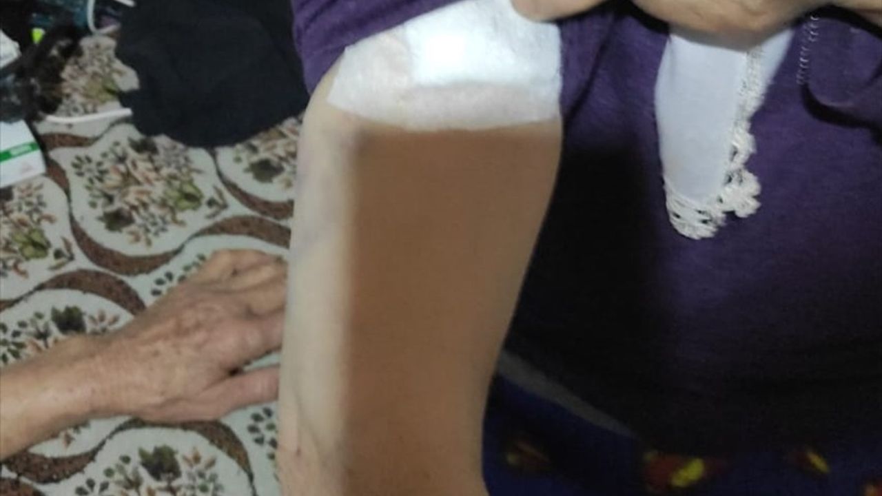 Burdur'da Sahipsiz Köpeklerin Saldırısında Yaşlı Kadın Yaralandı