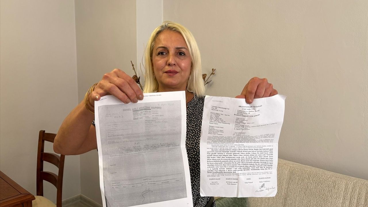 Adana'da Estetik İşlemde Yanık Oluştu: Kadın Şikayetçi