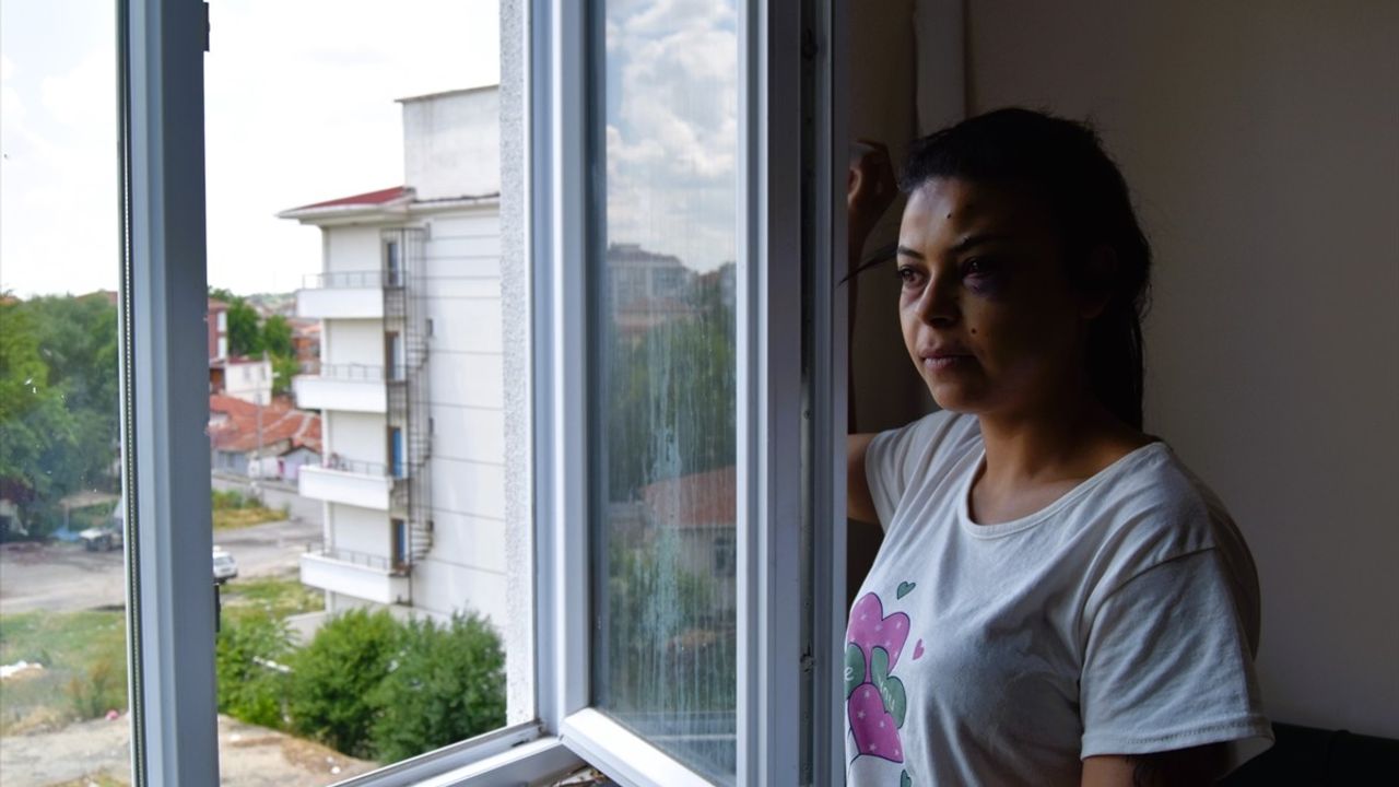 Kırklareli'nde Düğün Kavgası Kanlı Bitti: Bir Kadın Gözünden Yaralandı