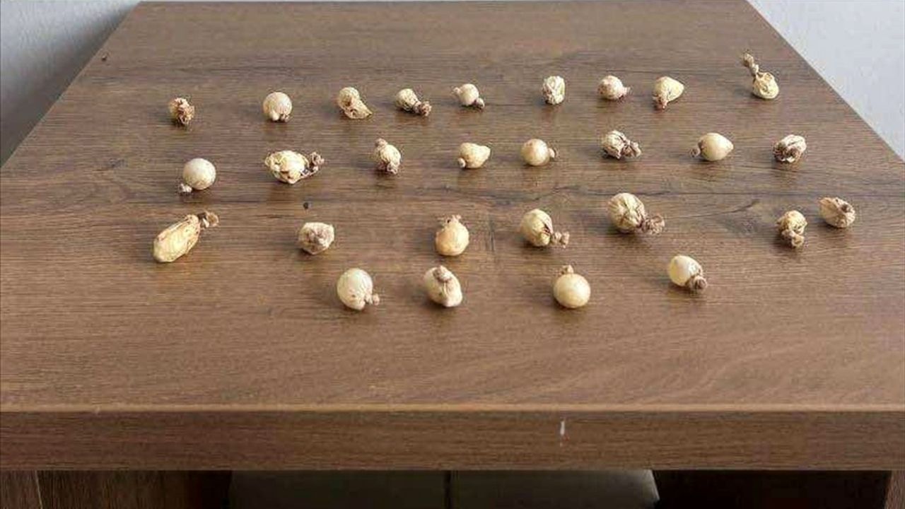 Kocaeli'de Jandarma Şüpheli Kişinin Midesinden Uyuşturucu Çıktı