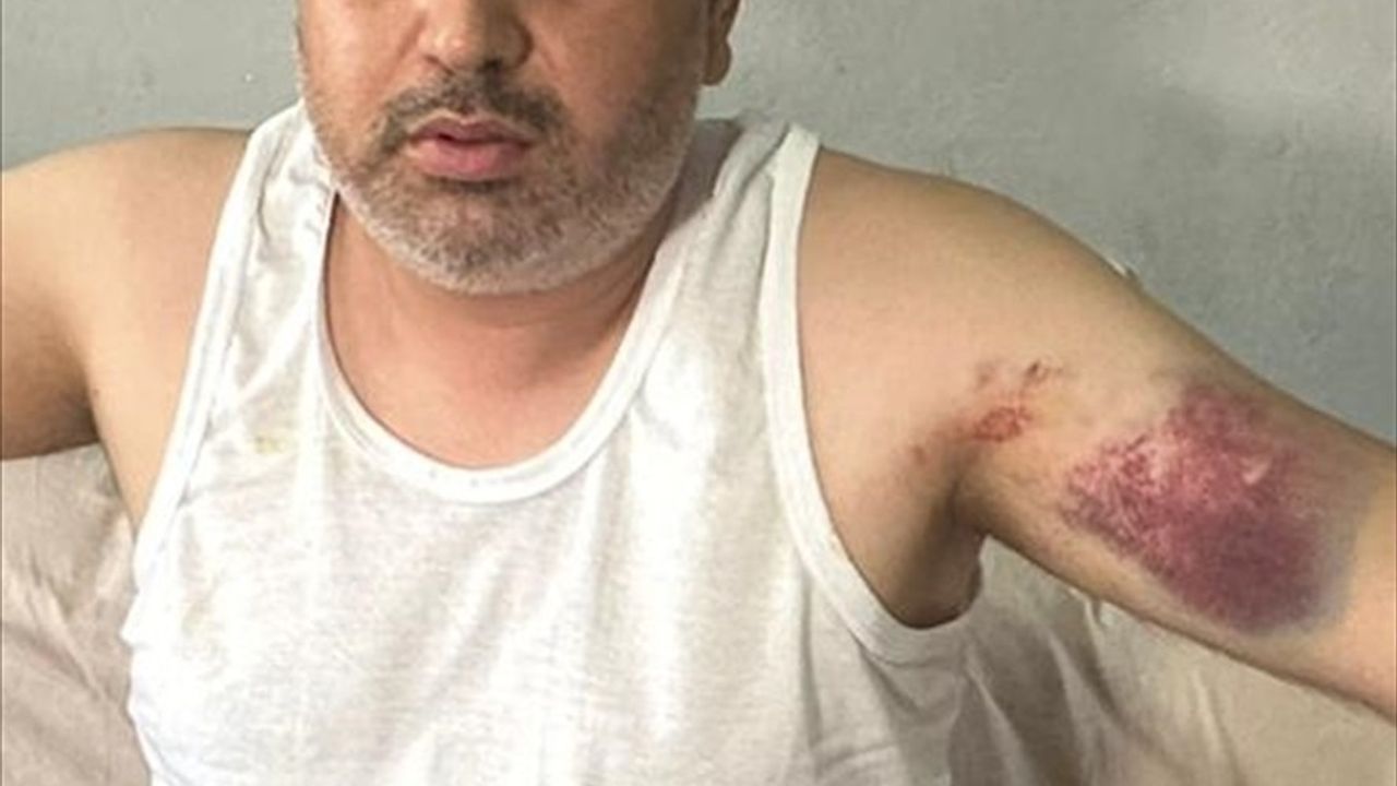 Adana'da Beyzbol Sopasıyla Saldırı: Dayı M.A. Tutuklandı