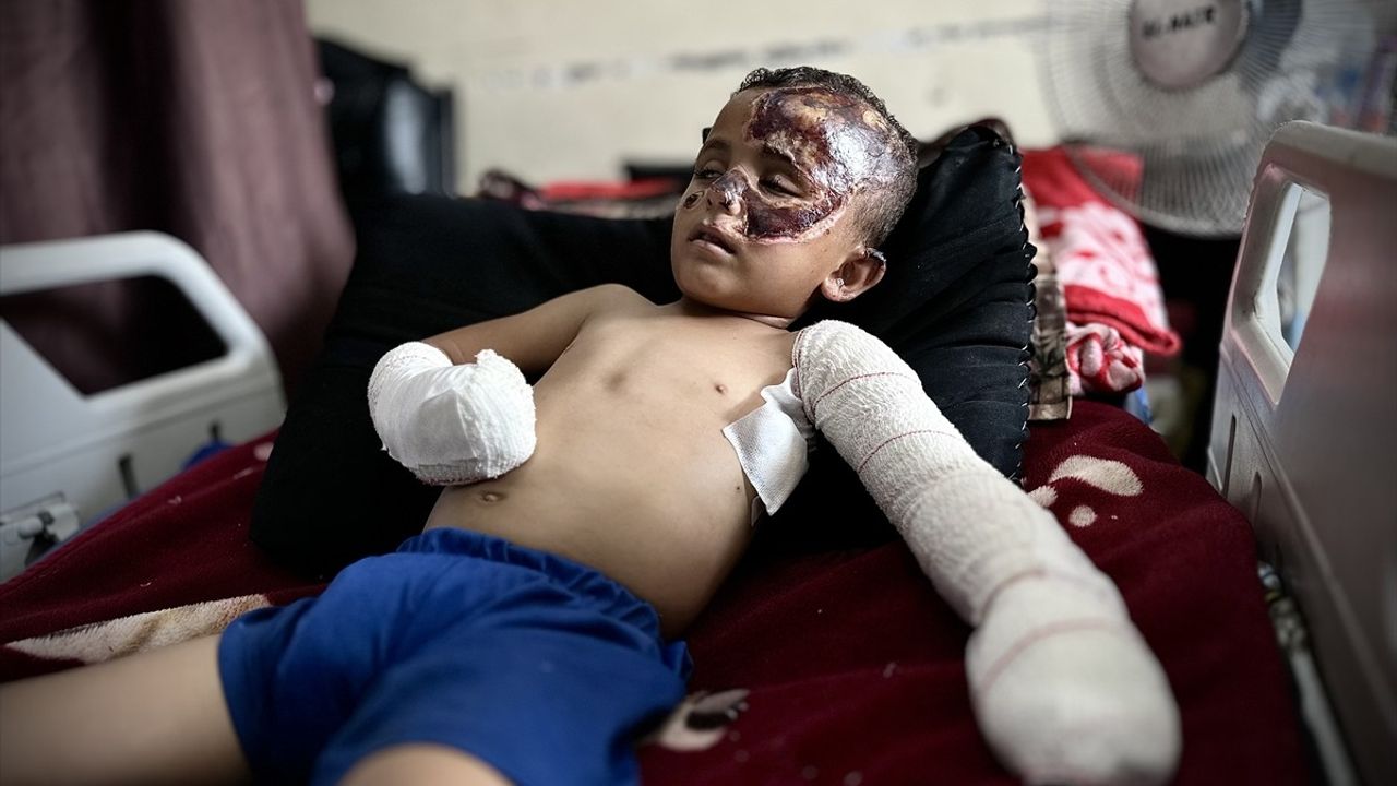 Gazze'de 4 Yaşındaki Ahmed, Saldırıda Yaralandı ve Yetim Kaldı