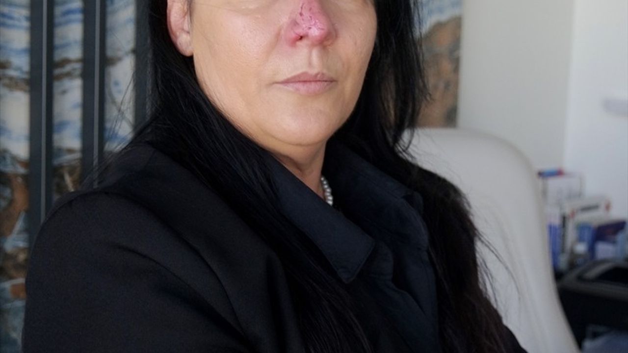 Bursa'da Rottweiler Saldırısı: Estetisyen Huriye Abikebahşi'nin Hukuk Mücadelesi