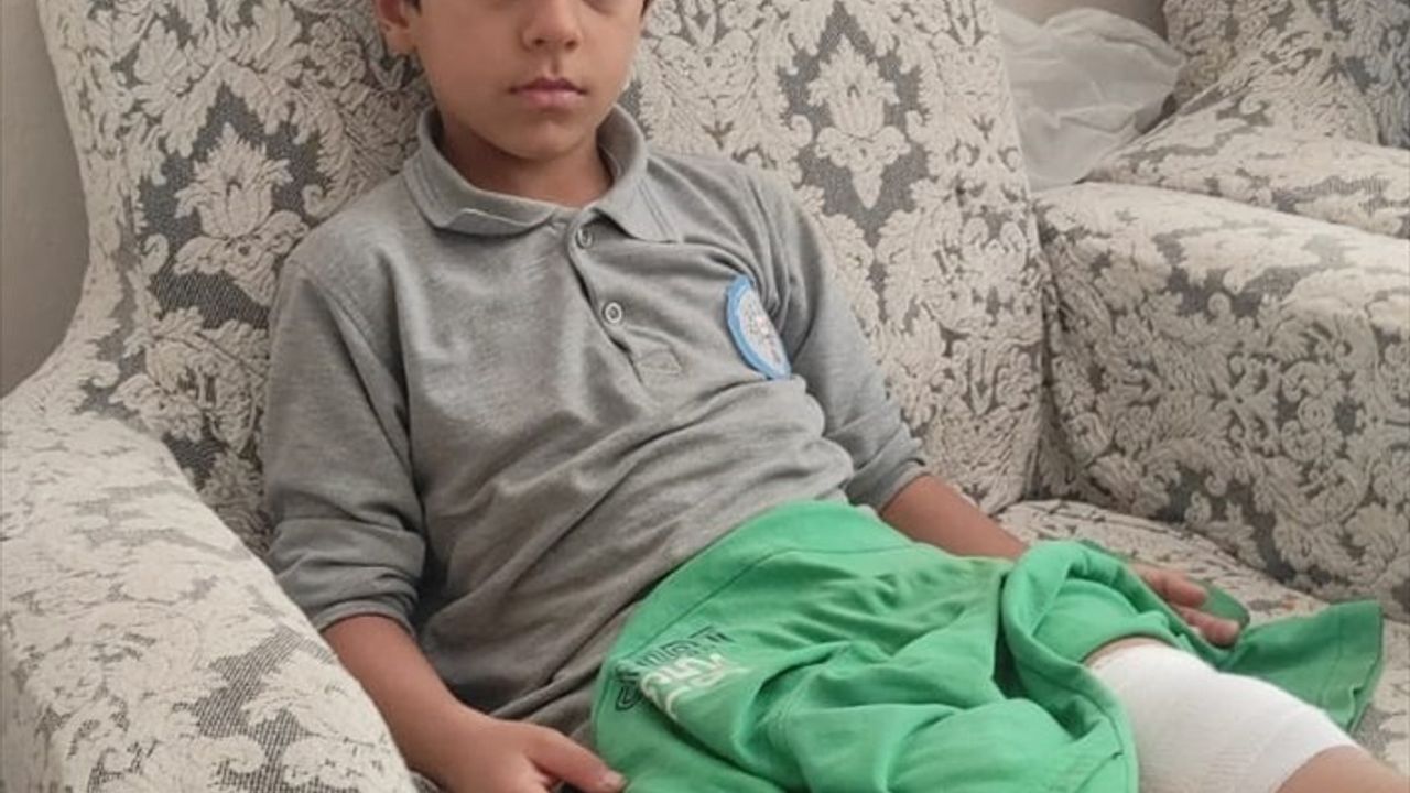 Bursa'da Sahipsiz Köpeğin Saldırısı: İ.A. (8) Bacağından Yaralandı