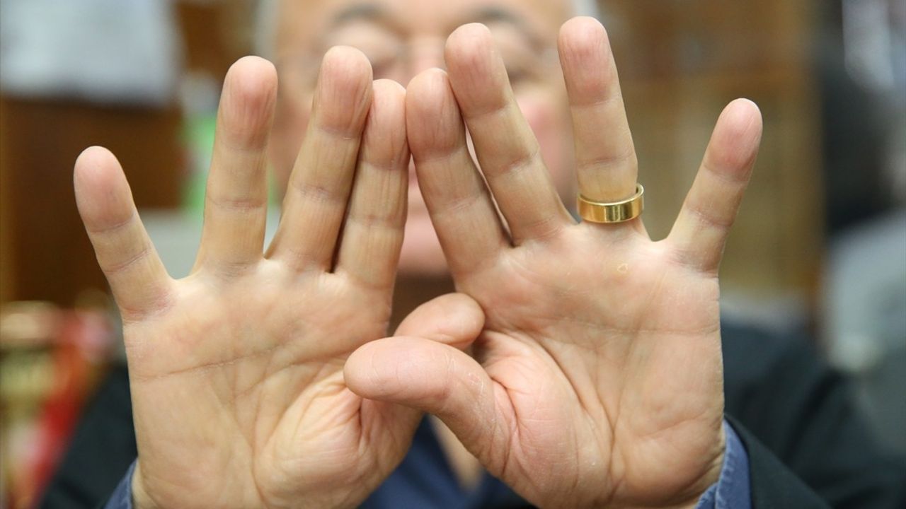 Kastamonu'da 58 Yıllık Gözlükçü İsmail Kargılı, 8 Parmak İzini Kaybetti