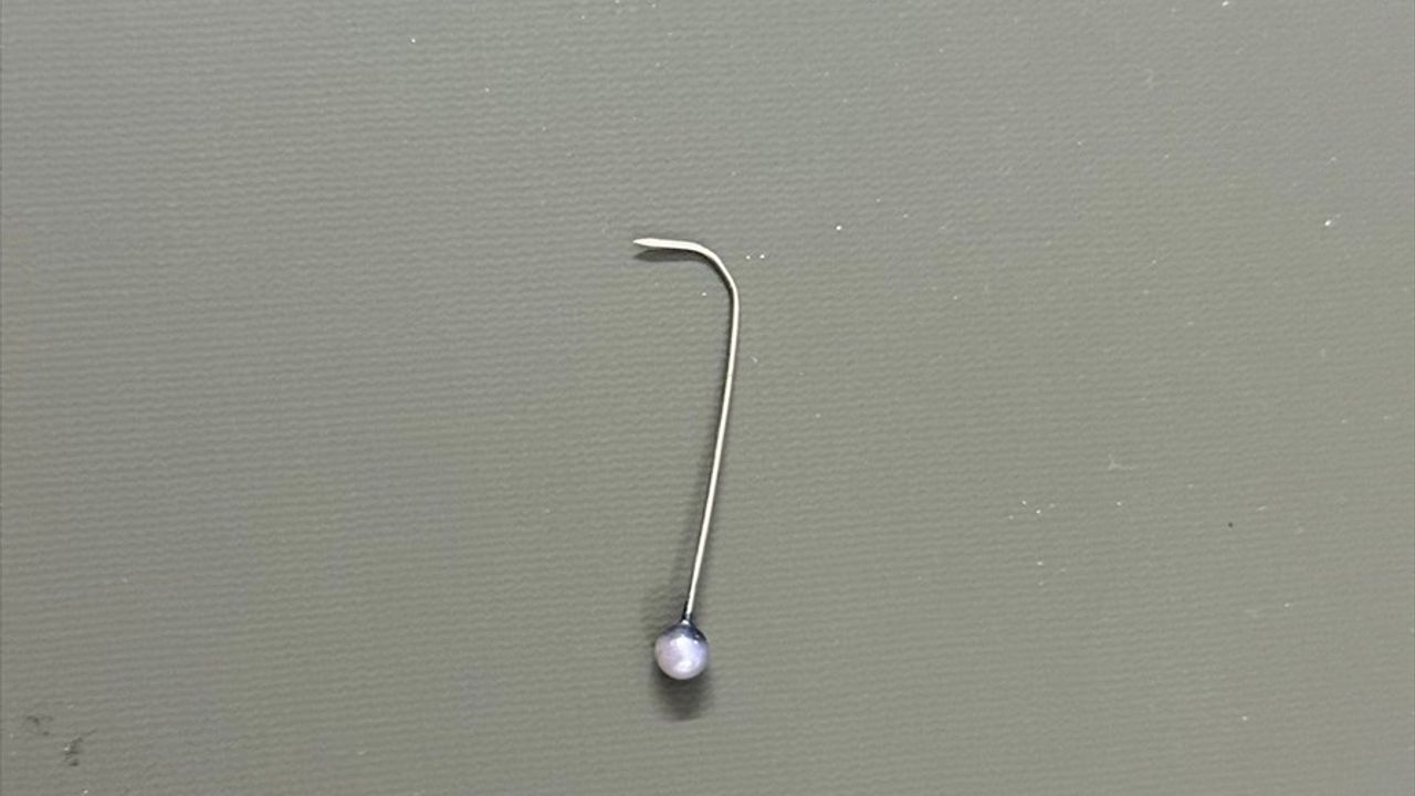 Şanlıurfa'da 16 Yaşındaki Kızın Yuttuğu Toplu İğne Ameliyatla Çıkarıldı