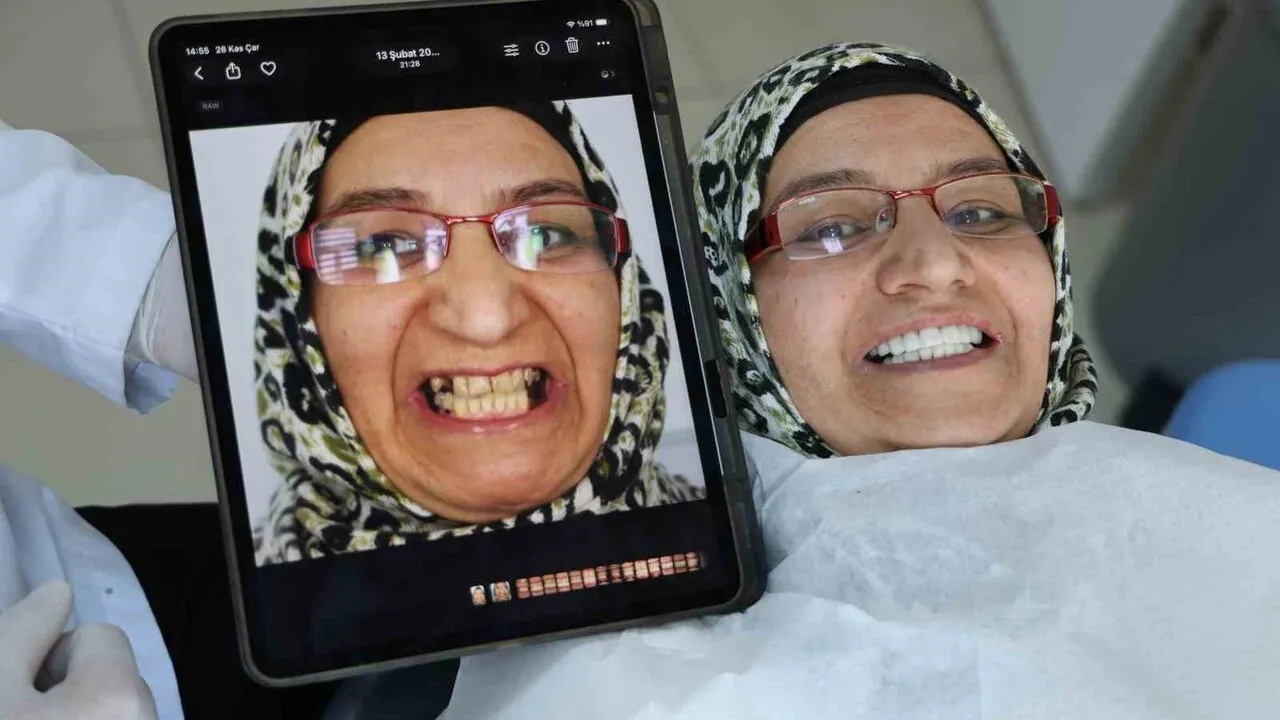 Cam Fiber Post ve Direkt Kompozit Lamina ile İmplant Bağımlılığı Azalıyor — Prof. Dr. İhsan Hubbezoğlu