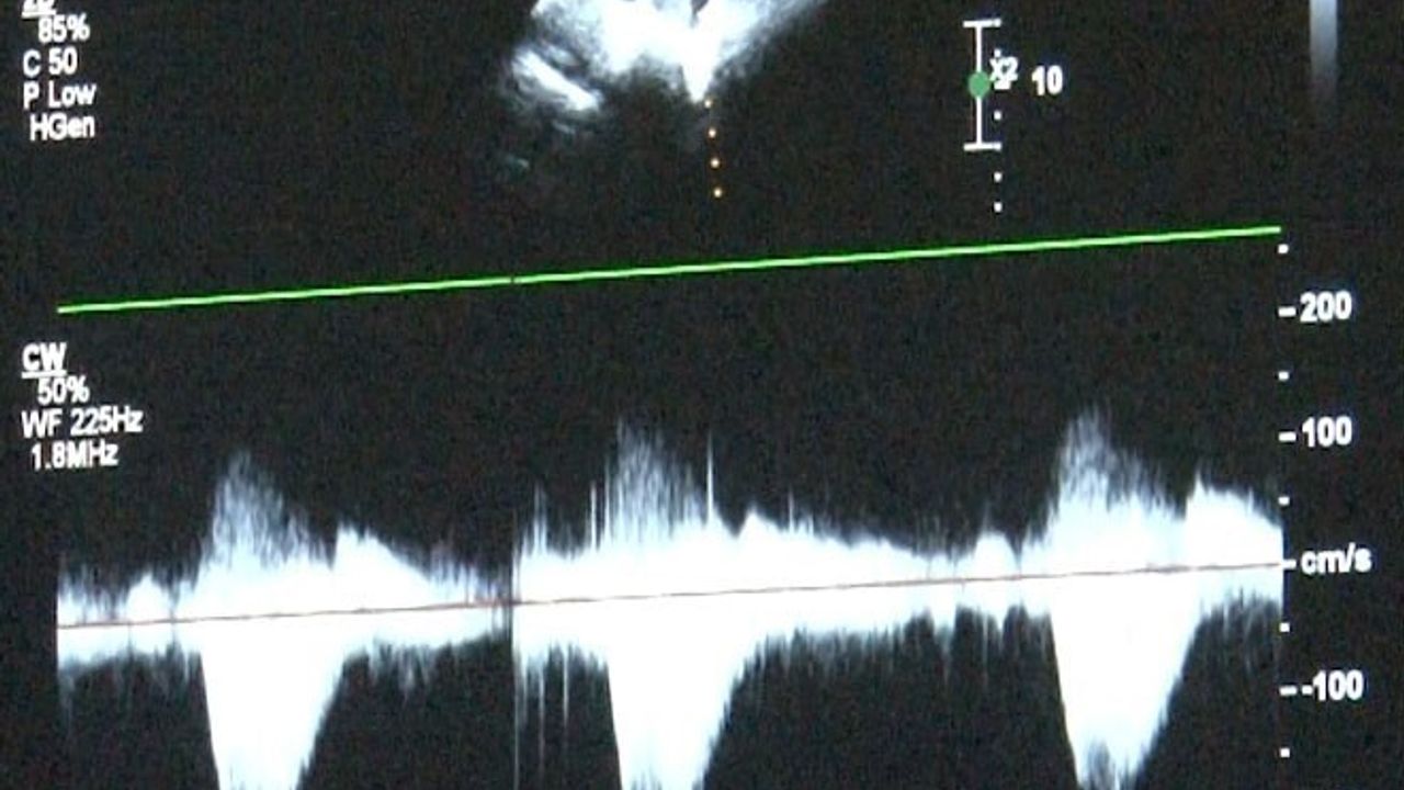 Çocuklarda Kalp Sağlığı: Yılda 12 Bin Doğumsal Vaka — Takipleri İhmal Etmeyin