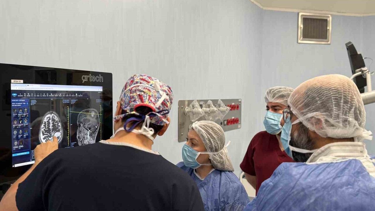 Gaziantep'te İlk Uyanık Kraniotomi Başarıyla Gerçekleştirildi
