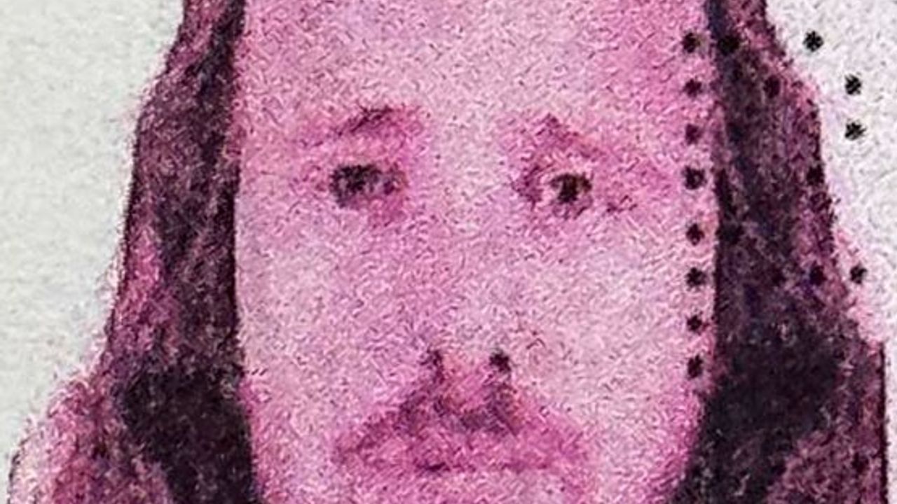 İngiliz Vatandaş Mentor Rama Türkiye'de Saç Ekimi ve Diş Tedavisi Sonrası Öldü