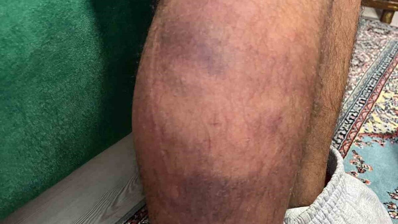 İzmit'te vicdanları yaralayan saldırı: Otizmli Ertuğrul Şenol odunla darbedildi