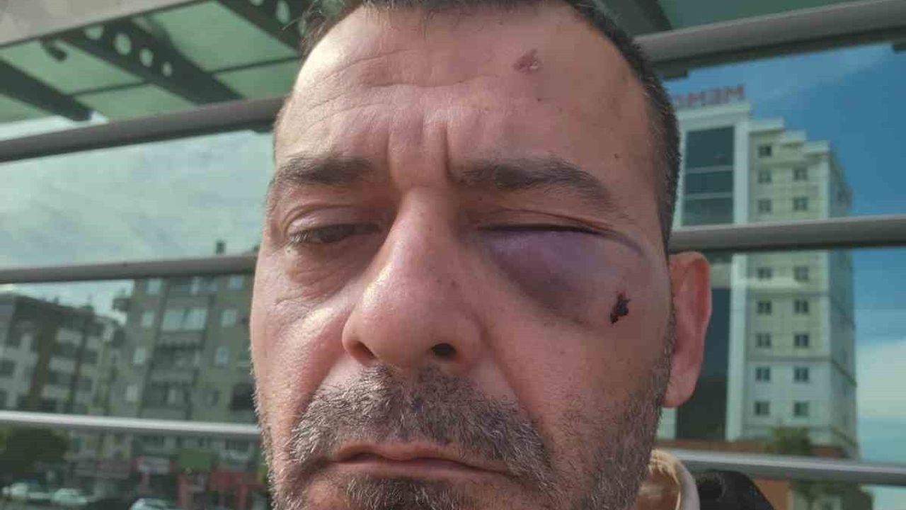 Kayseri'de Kukla Sanatçısı Adem Ocaktan ve Oğlu Sopayla Darp Edildi