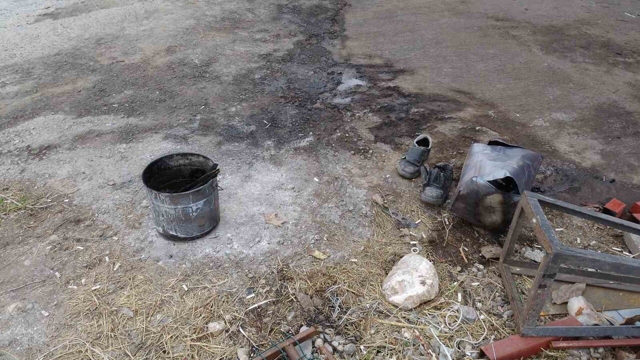 Malatya'da Stajyer Öğrenciler Ateşe Tiner Döktü: 2 Yaralı