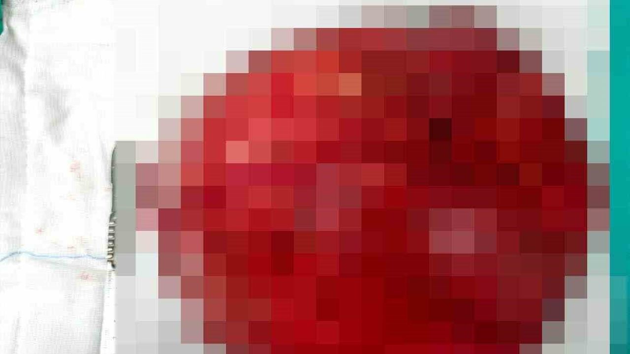 Akşehir'de rahim kaynaklı 40 santimetrelik kitle başarıyla çıkarıldı