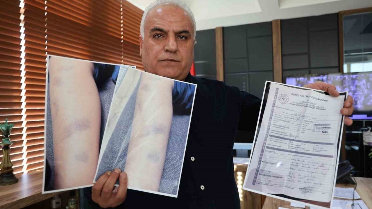 Diyarbakır'da 8 Yaşındaki Çocuğun Darp İddiası: Okul ve Aile Karşı Karşıya