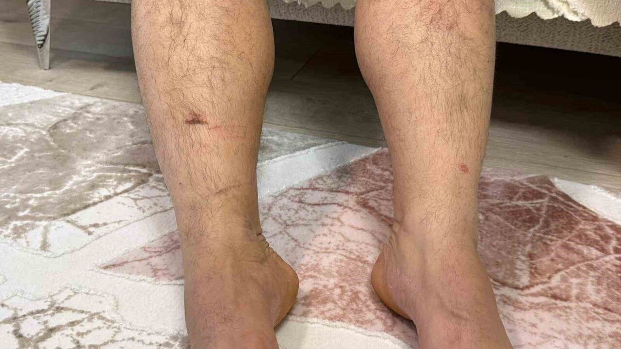 Diyarbakır'da İcra İddiası: Murat Hilez Kuzenleri Tarafından Kaçırıldığını Öne Sürdü