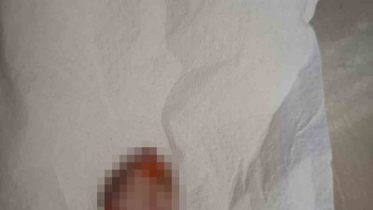 Kopan Parmağını Buz Poşetiyle Koruyup 600 km Geldi, Türkiye'de Dikildi