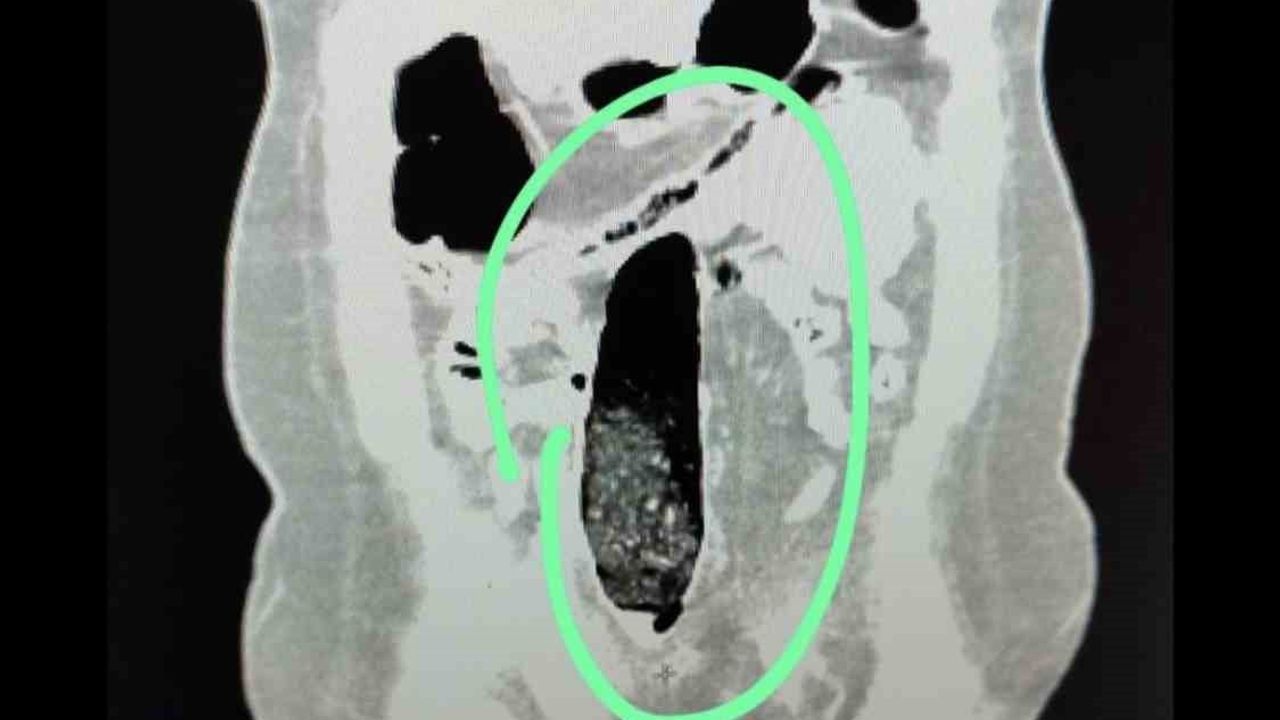 Muş'ta Otobüste Uyuşturucu Sevkiyatına Polis Engeli: 2 Tutuklama