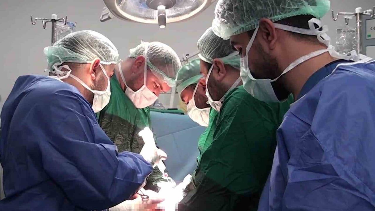 Şanlıurfa'da 25 Santimetrelik Dev Kist Ameliyatla Çıkarıldı