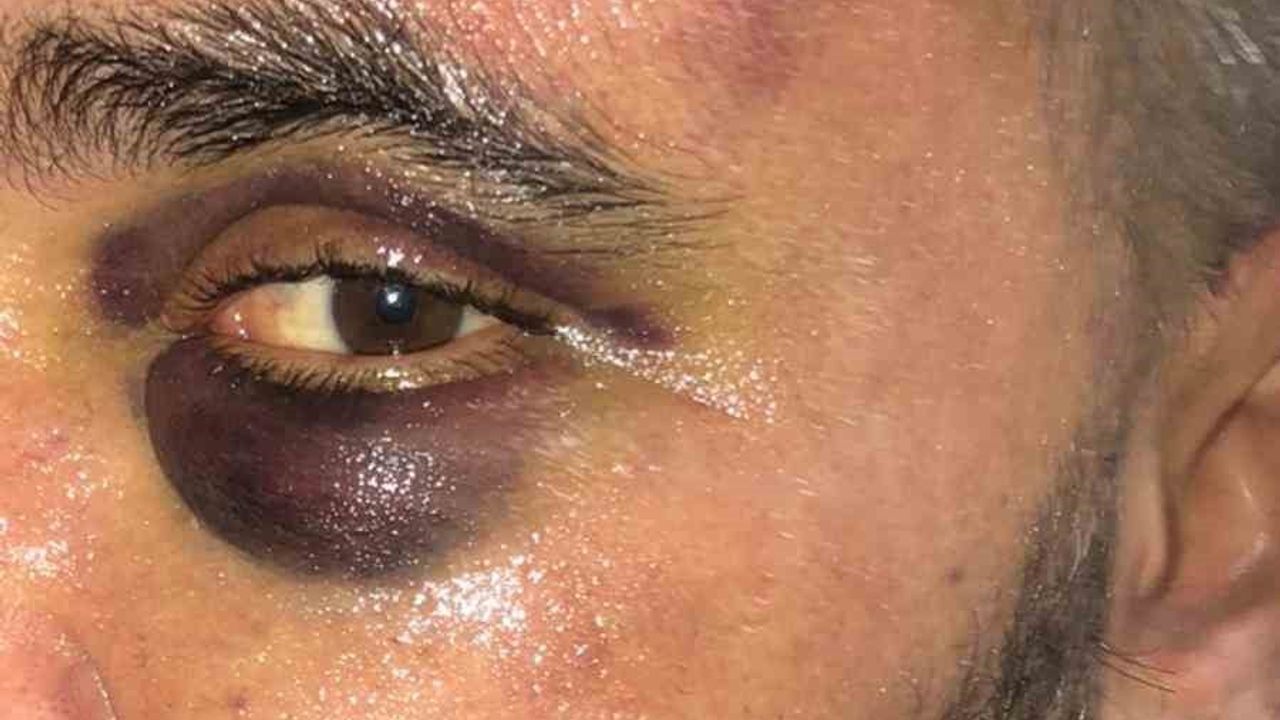 Afyonkarahisar'da İş Yeri Sahibine Kamera Önünde Vahşi Darp — Şahıslar Serbest