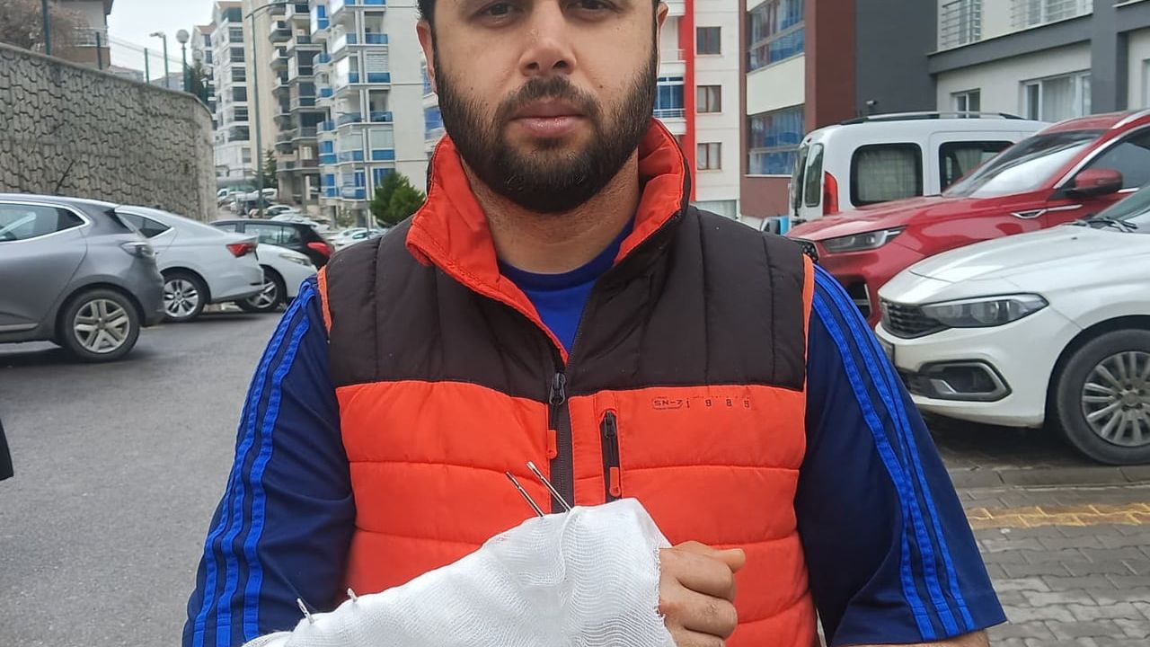 Ankara Mamak'ta Sahipsiz Köpeklerden Kaçarken Bile…