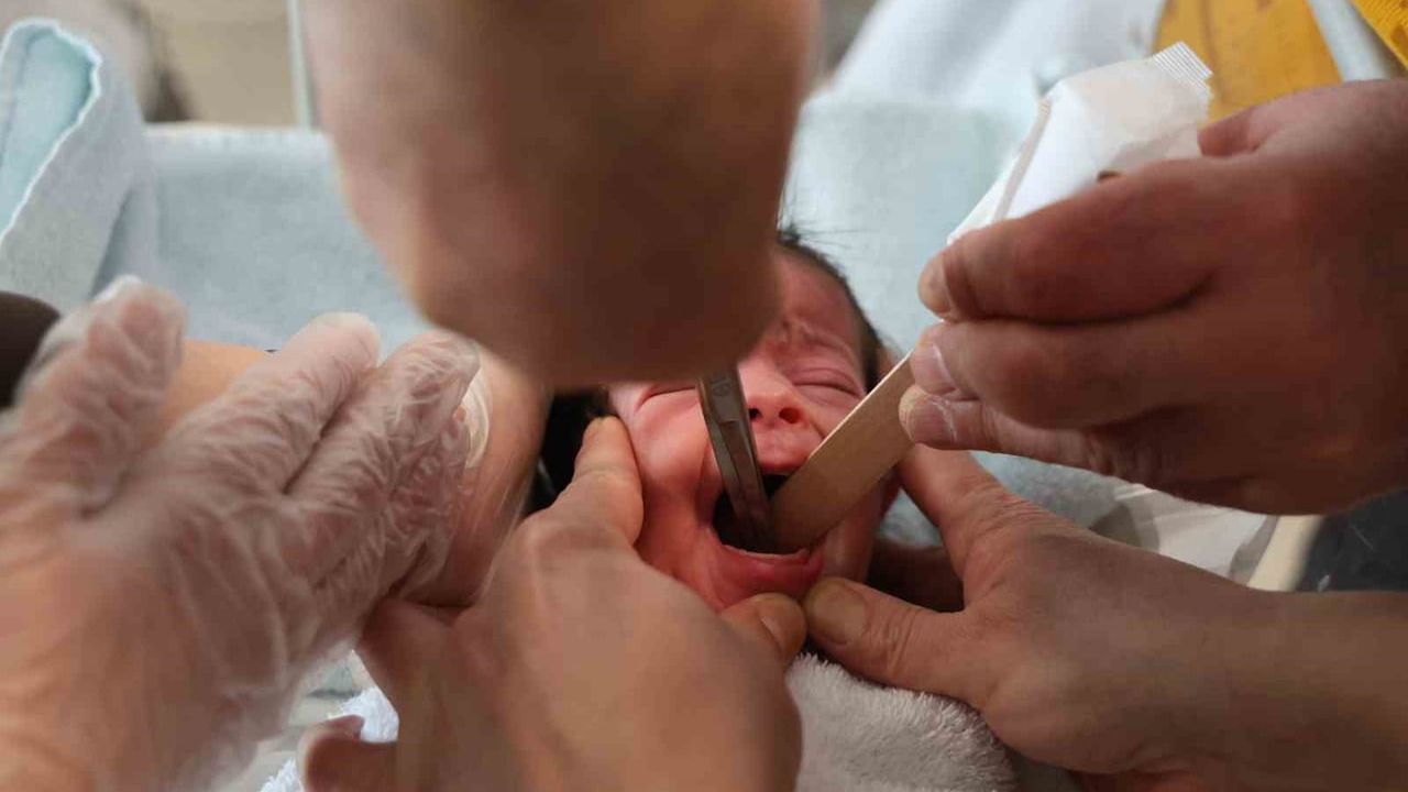 Doğuştan yemek borusu olmayan Ada bebek Elazığ'da hayata tutundu