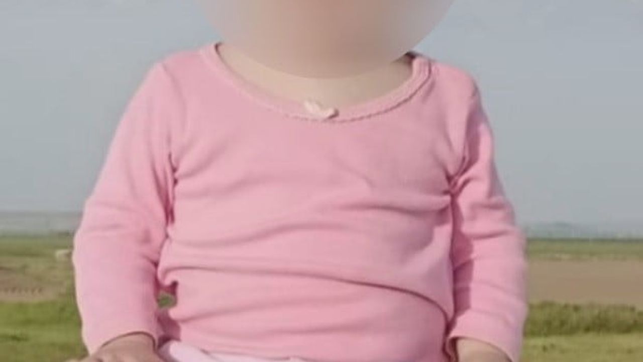 Down Sendromu Bildirilmedi: Doktora 81 Milyon TL Tazminat