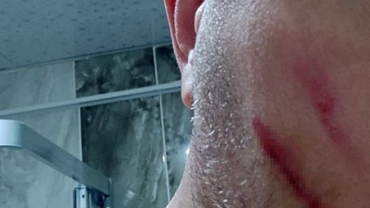 Elazığ'da Kavga: Yolcunun Duvara Tuvaleti Tartışmayı Büyüttü