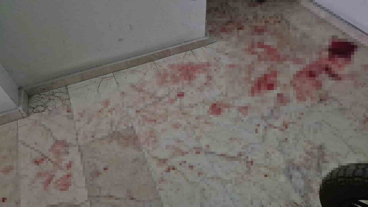 Eskişehir'de Üvey Babasını Bıçakladı: 50 Yaşındaki Adam Ağır Yaralandı