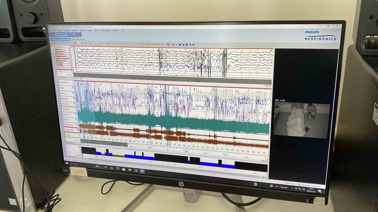 Eskişehir Şehir Hastanesi'nde Nörolojide İleri Tedavi İmkanları