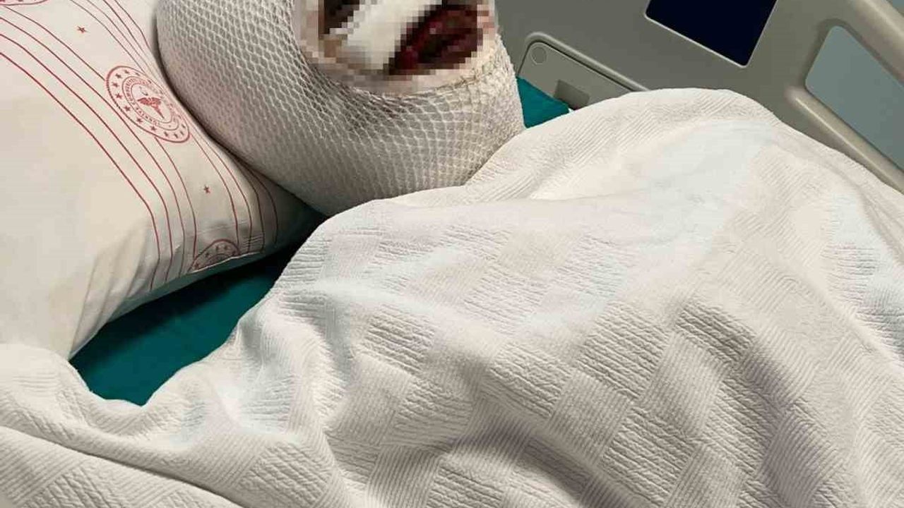 Gaziantep’te Eski Koca Asitli Saldırı: Kadın Yoğun Bakımda, Şüpheli Tutuklandı