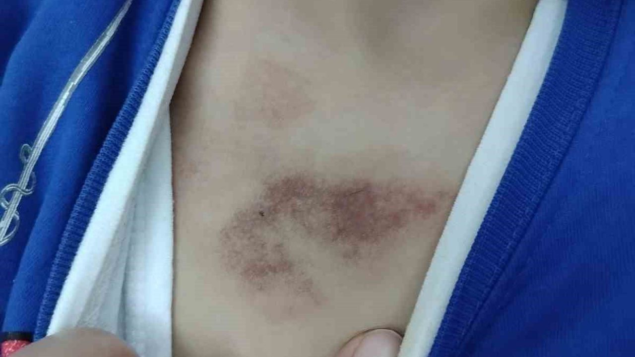 İBB Kreşinde İstismar ve Darp İddiası: Eyüpsultan Ailesi Şikayetçi