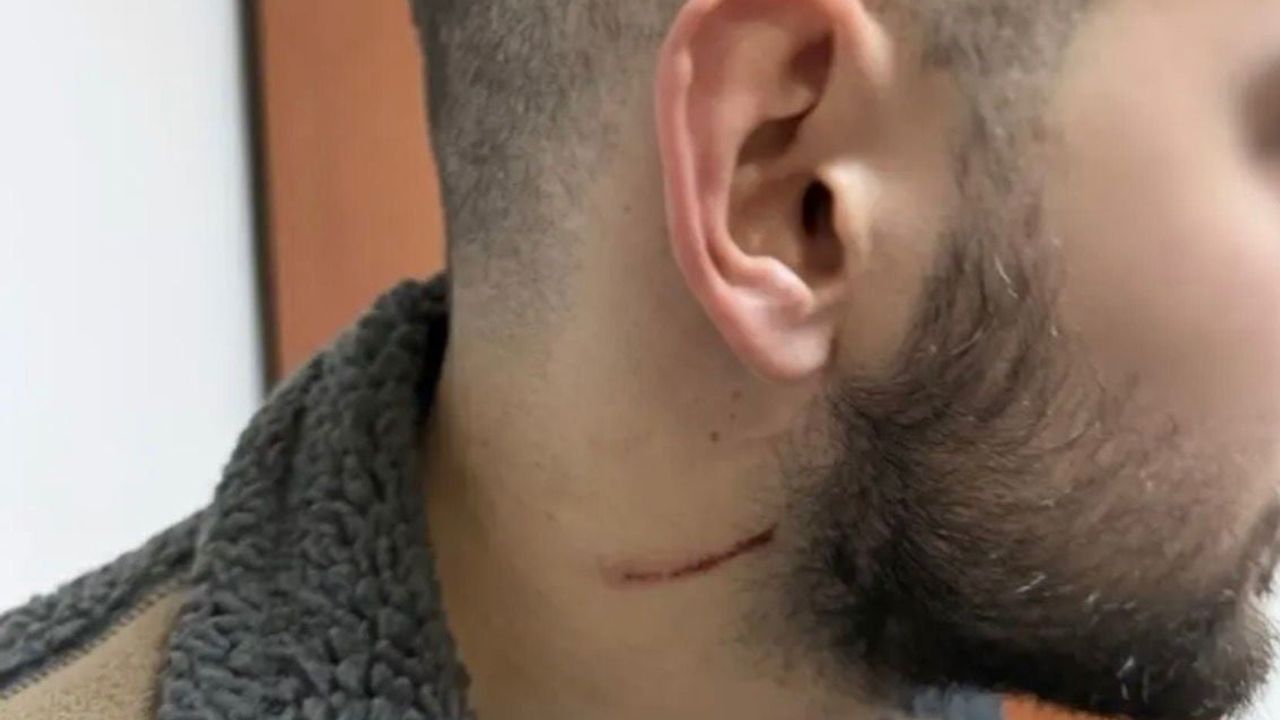 Kartepe’de ATV Kavgası: Çocuklar Mağdur Oldu