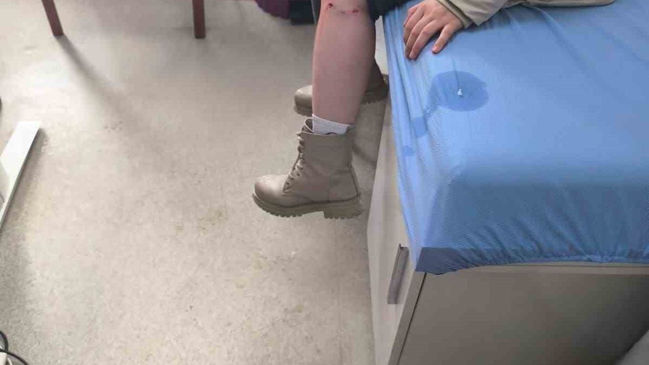 Kayseri Tomarza'da Sokak Köpeği Saldırısı: Kız Çocuğu Yaralandı