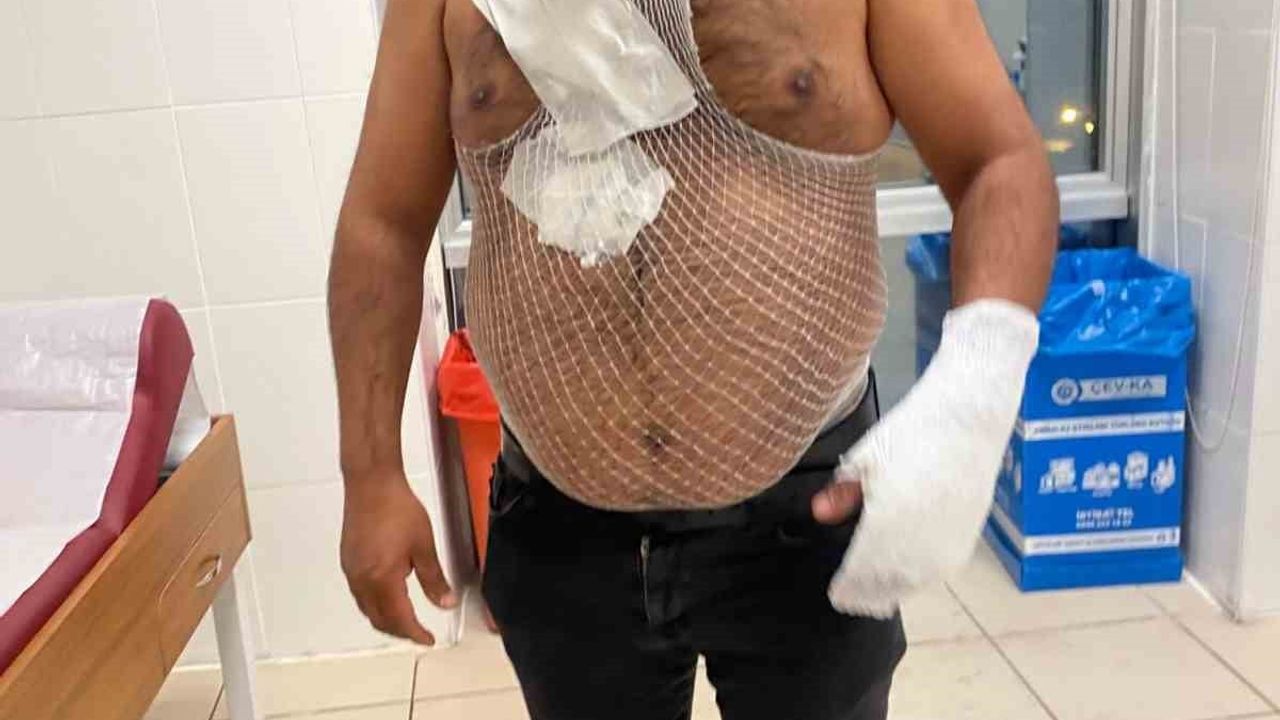 Meşhur Tostçu Raşit Yıldırım, Soğuk Hava Şovunda Yanarak Yaralandı