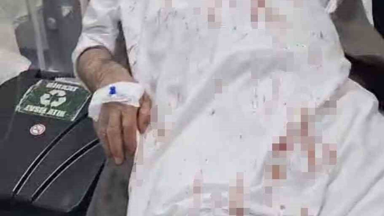 Şanlıurfa Viranşehir'de 72 Yaşındaki Adam Sopalarla Darp Edildi — 4 Şüpheli Tutuklandı