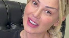 Petek Dinççöz’ün Makyajsız Hali: Estetik Sonrası İlk Paylaşım