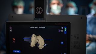 Atatürk Üniversitesi'nde Robotik Cerrahi ile Başarıyla Diz Protezi Ameliyatı Yapıldı
