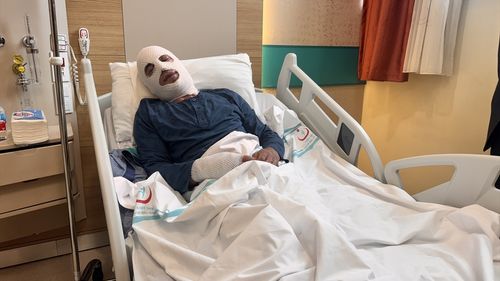 Erzurum'da Sprey Boya Tüpü Patladı: Genç Ağır Yaralandı