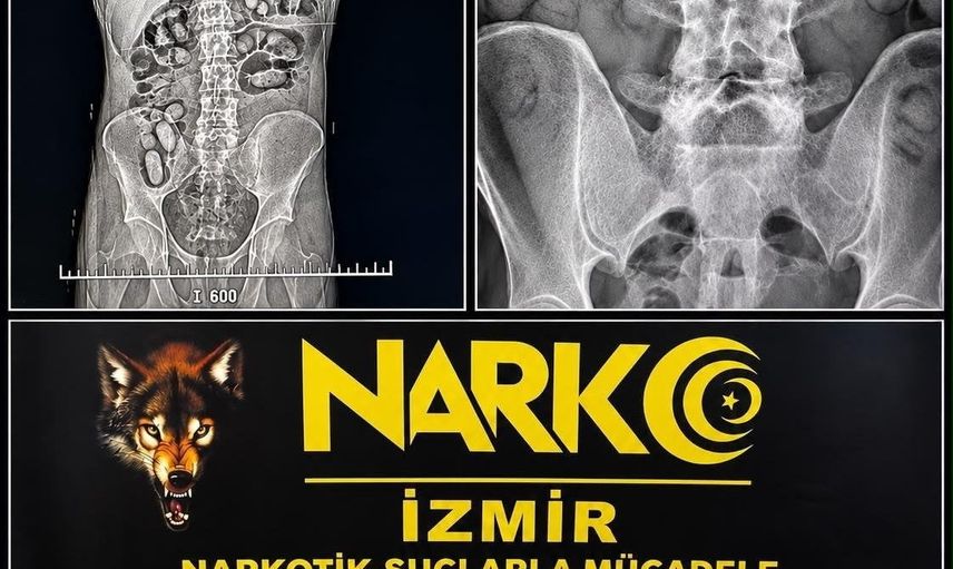 Kapsüller içinde taşınan uyuşturucu, havalimanı takibiyle ortaya çıktı