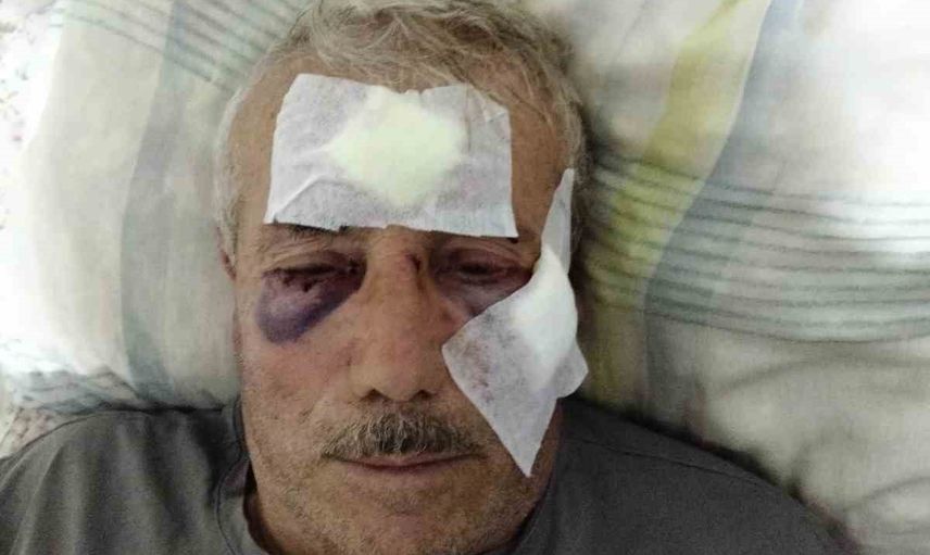 Bahçe sınırı kavgası güvenlik kamerasına yansıdı: öğretmen muşta ile komşusunu yaraladı