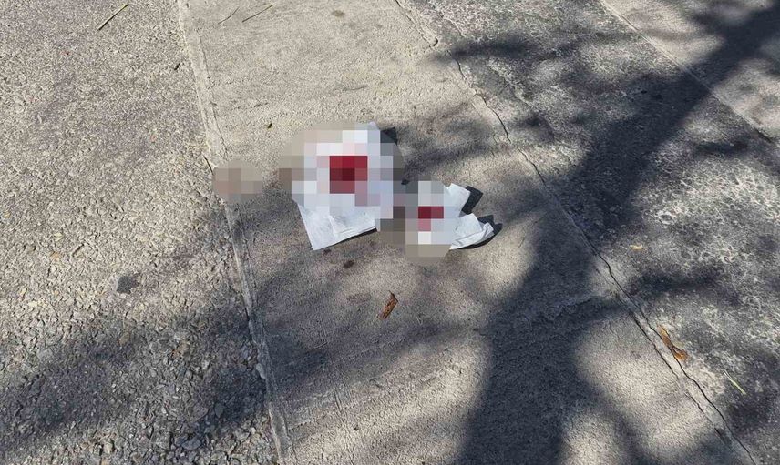 Eskişehir'de babayla oğlu arasındaki tartışma bıçaklı kavgaya dönüştü