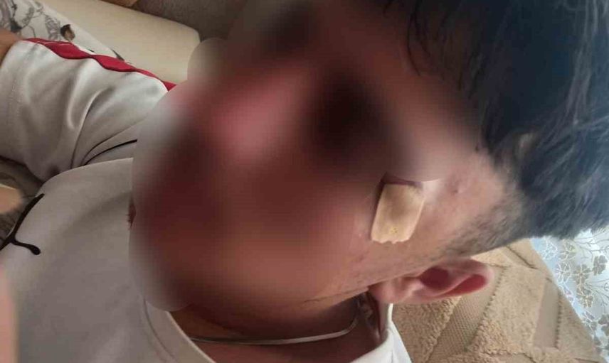 çıraklık eğitim merkezinde öğretmen müdahalesi sonrası 16 yaşındaki öğrencinin burnu kırıldı